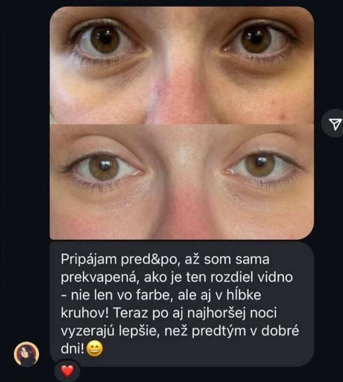 Recence klientky Bora Esthetic Institutu 8